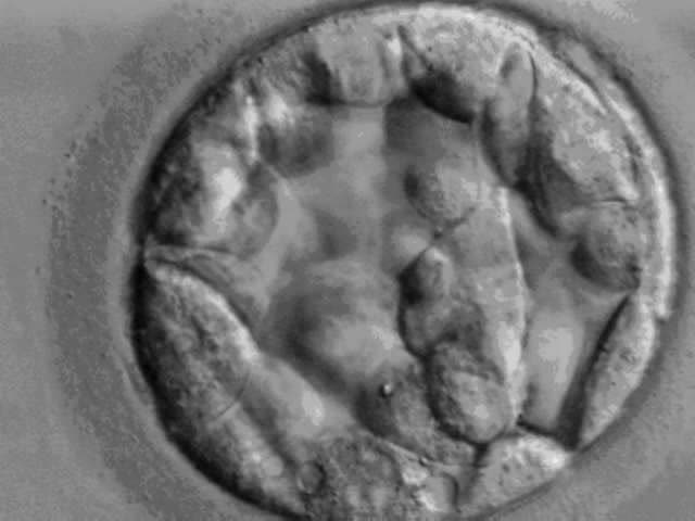 Microscope image of a human blastocyst on day 5 after fertilisation