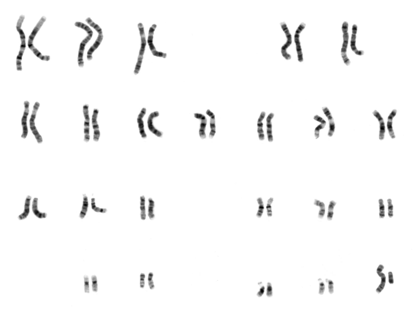 A karyogram: the 22 pairs of autosomes and the X and Y chromosomes of a human male, arranged by size
